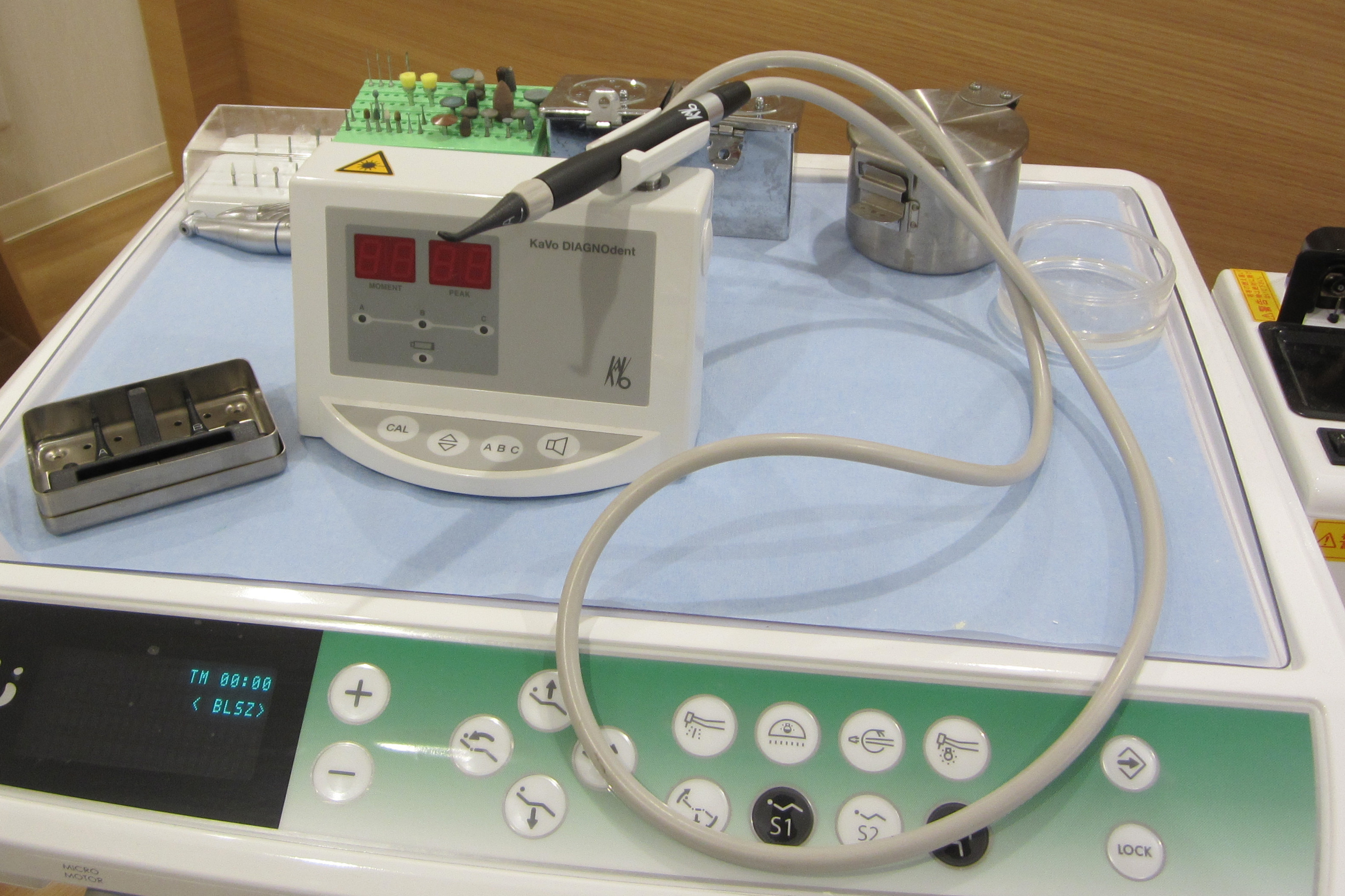 ダイアグノデント